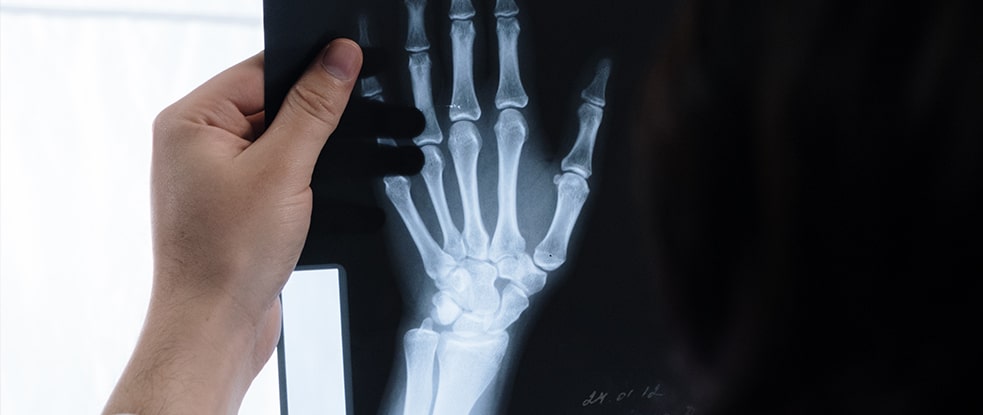 raio-x-mao.jpg
